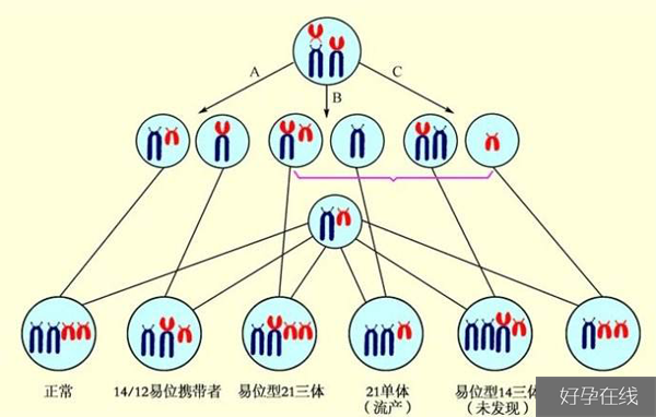 染色体异常