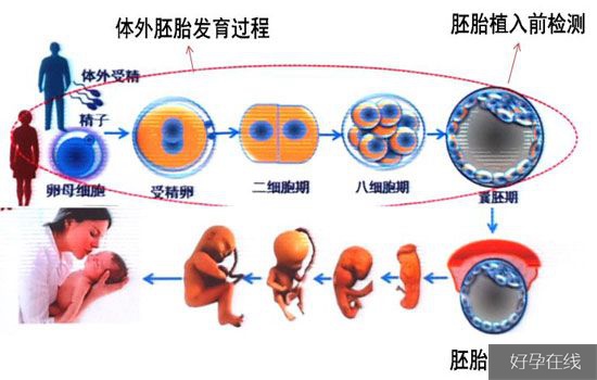 供精试管婴儿的具体流程