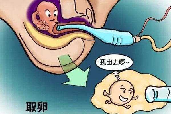 什么是人工受孕