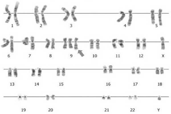 9号染色体