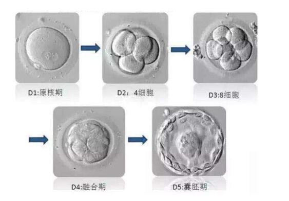 为什么泰国试管婴儿